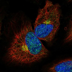 Invitrogen MPPE1 Polyclonal Antibody 100 &mu;L; Unconjugated:Antibodies,
