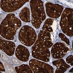 Invitrogen MPPE1 Polyclonal Antibody 100 &mu;L; Unconjugated:Antibodies,