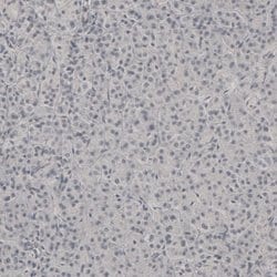 Invitrogen PLA2R1 Polyclonal Antibody 100 &mu;L; Unconjugated:Antibodies,