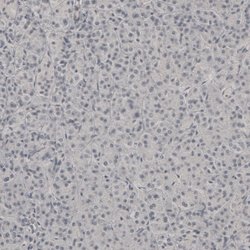 Invitrogen PLA2R1 Polyclonal Antibody 100 &mu;L; Unconjugated:Antibodies,