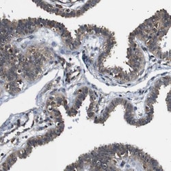 Invitrogen UBXN1 Polyclonal Antibody 100 &mu;L; Unconjugated:Antibodies,