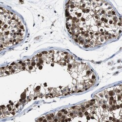Invitrogen UBXN1 Polyclonal Antibody 100 &mu;L; Unconjugated:Antibodies,