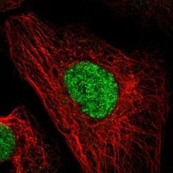 Invitrogen DACH1 Polyclonal Antibody 100 &mu;L; Unconjugated:Antibodies,