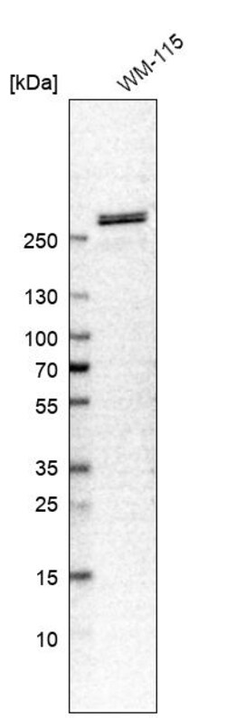 Invitrogen SPTBN1 Polyclonal Antibody 100 &mu;L; Unconjugated:Antibodies,