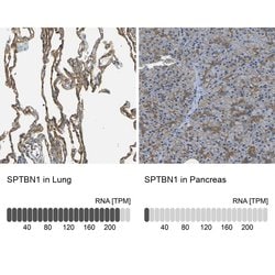 Invitrogen SPTBN1 Polyclonal Antibody 100 &mu;L; Unconjugated:Antibodies,
