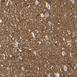 Invitrogen SPTBN1 Polyclonal Antibody 100 &mu;L; Unconjugated:Antibodies,