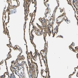 Invitrogen SPTBN1 Polyclonal Antibody 100 &mu;L; Unconjugated:Antibodies,