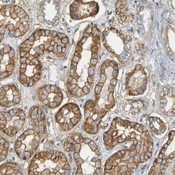 Invitrogen SPTBN1 Polyclonal Antibody 100 &mu;L; Unconjugated:Antibodies,