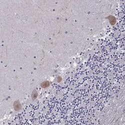 Invitrogen FGF3 Polyclonal Antibody 100 &mu;L; Unconjugated:Antibodies,
