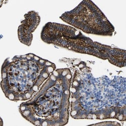 Invitrogen PTPRF Polyclonal Antibody 100 &mu;L; Unconjugated:Antibodies,