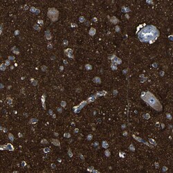 Invitrogen CSP alpha Polyclonal Antibody 100 &mu;L; Unconjugated:Antibodies,