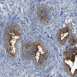 Invitrogen CSP alpha Polyclonal Antibody 100 &mu;L; Unconjugated:Antibodies,