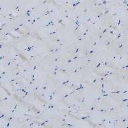 Invitrogen CSP alpha Polyclonal Antibody 100 &mu;L; Unconjugated:Antibodies,
