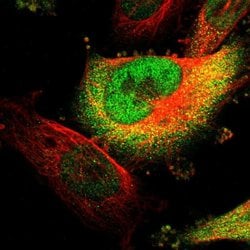 Invitrogen PIGL Polyclonal Antibody 100 &mu;L; Unconjugated:Antibodies,