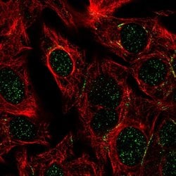 Invitrogen DPEP1 Polyclonal Antibody 100 &mu;L; Unconjugated:Antibodies,