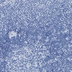 Invitrogen DPEP1 Polyclonal Antibody 100 &mu;L; Unconjugated:Antibodies,