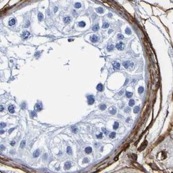 Invitrogen DPEP1 Polyclonal Antibody 100 &mu;L; Unconjugated:Antibodies,