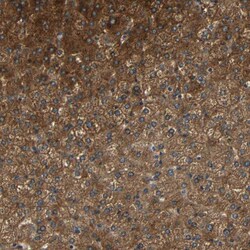 Invitrogen FNDC3A Polyclonal Antibody 100 &mu;L; Unconjugated:Antibodies,