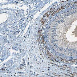 Invitrogen ZMAT1 Polyclonal Antibody 100 &mu;L; Unconjugated:Antibodies,
