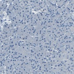 Invitrogen ZMAT1 Polyclonal Antibody 100 &mu;L; Unconjugated:Antibodies,