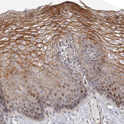 Invitrogen ABHD9 Polyclonal Antibody 100 &mu;L; Unconjugated:Antibodies,
