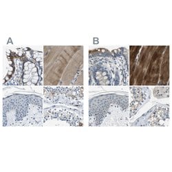 Invitrogen STBD1 Polyclonal Antibody 100 &mu;L; Unconjugated:Antibodies,