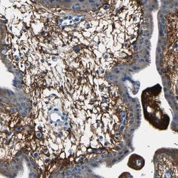 Invitrogen Fibrillin 2 Polyclonal Antibody 100 &mu;L; Unconjugated:Antibodies,