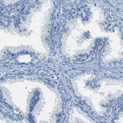 Invitrogen Fibrillin 2 Polyclonal Antibody 100 &mu;L; Unconjugated:Antibodies,