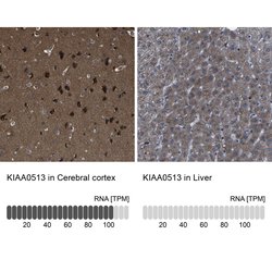 Invitrogen KIAA0513 Polyclonal Antibody 100 &mu;L; Unconjugated:Antibodies,