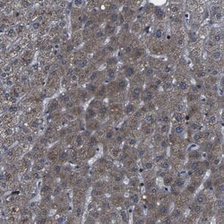 Invitrogen KIAA0513 Polyclonal Antibody 100 &mu;L; Unconjugated:Antibodies,