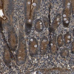 Invitrogen PDE5 Polyclonal Antibody 100 &mu;L | Buy Online | Invitrogen&trade; | Fisher Scientific