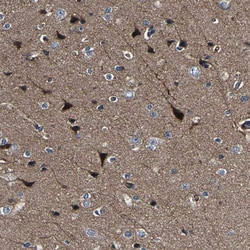 Invitrogen CENTG3 Polyclonal Antibody 100 &mu;L; Unconjugated:Antibodies,