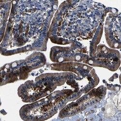 Invitrogen CENTG3 Polyclonal Antibody 100 &mu;L; Unconjugated:Antibodies,