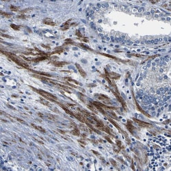 Invitrogen CENTG3 Polyclonal Antibody 100 &mu;L; Unconjugated:Antibodies,