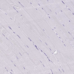 Invitrogen Cathepsin E Polyclonal Antibody 100 &mu;L | Buy Online | Invitrogen&trade; | Fisher Scientific