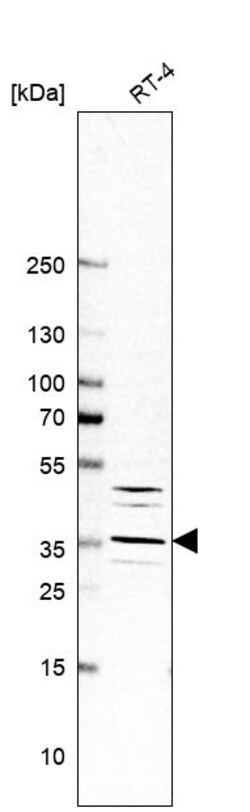 Invitrogen Cathepsin E Polyclonal Antibody 100 &mu;L | Buy Online | Invitrogen&trade; | Fisher Scientific