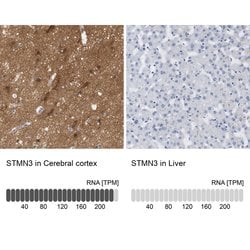 Invitrogen STMN3 Polyclonal Antibody 100 &mu;L; Unconjugated:Antibodies,