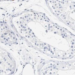 Invitrogen STMN3 Polyclonal Antibody 100 &mu;L; Unconjugated:Antibodies,