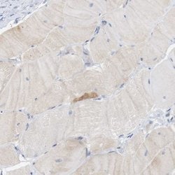 Invitrogen STMN3 Polyclonal Antibody 100 &mu;L; Unconjugated:Antibodies,