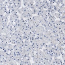 Invitrogen STMN3 Polyclonal Antibody 100 &mu;L; Unconjugated:Antibodies,