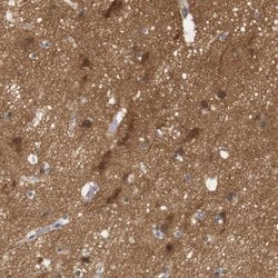 Invitrogen STMN3 Polyclonal Antibody 100 &mu;L; Unconjugated:Antibodies,