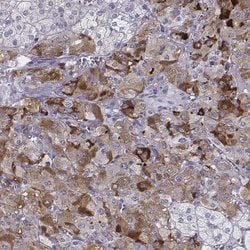 Invitrogen PENK Polyclonal Antibody 100 &mu;L; Unconjugated:Antibodies,