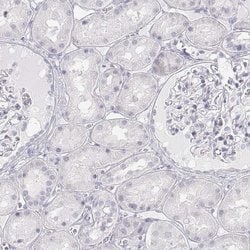Invitrogen PENK Polyclonal Antibody 100 &mu;L; Unconjugated:Antibodies,