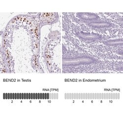 Invitrogen BEND2 Polyclonal Antibody 100 &mu;L; Unconjugated:Antibodies,