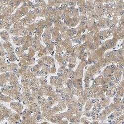 Invitrogen VAPB Polyclonal Antibody 100 &mu;L; Unconjugated:Antibodies,