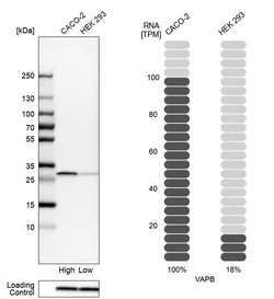 Invitrogen VAPB Polyclonal Antibody 100 &mu;L; Unconjugated:Antibodies,