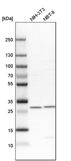Invitrogen VAPB Polyclonal Antibody 100 &mu;L; Unconjugated:Antibodies,
