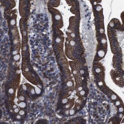 Invitrogen SPTBN1 Polyclonal Antibody 100 &mu;L; Unconjugated:Antibodies,