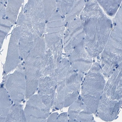Invitrogen Claudin 11 Polyclonal Antibody 100 &mu;L; Unconjugated:Antibodies,
