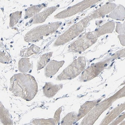 Invitrogen GPR158 Polyclonal Antibody 100 &mu;L | Buy Online | Invitrogen&trade; | Fisher Scientific